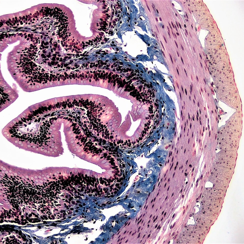 Doll Fire Ring - obrazek 1